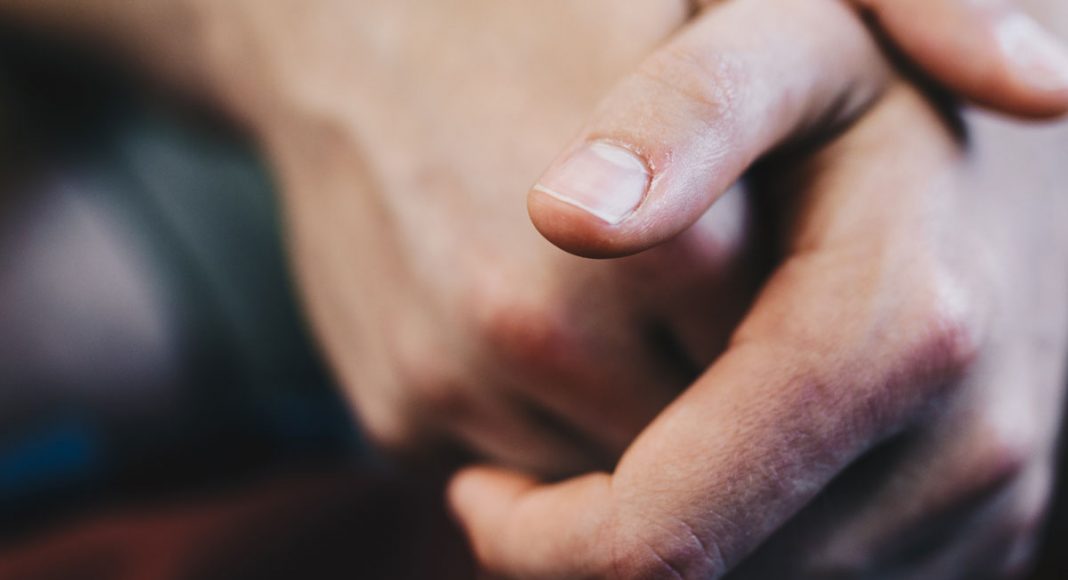 How Cannabis Can Help Those Who Suffer With Psoriasis