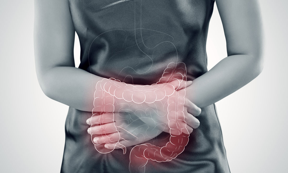 rx irritable bowel syndrome and cannabis