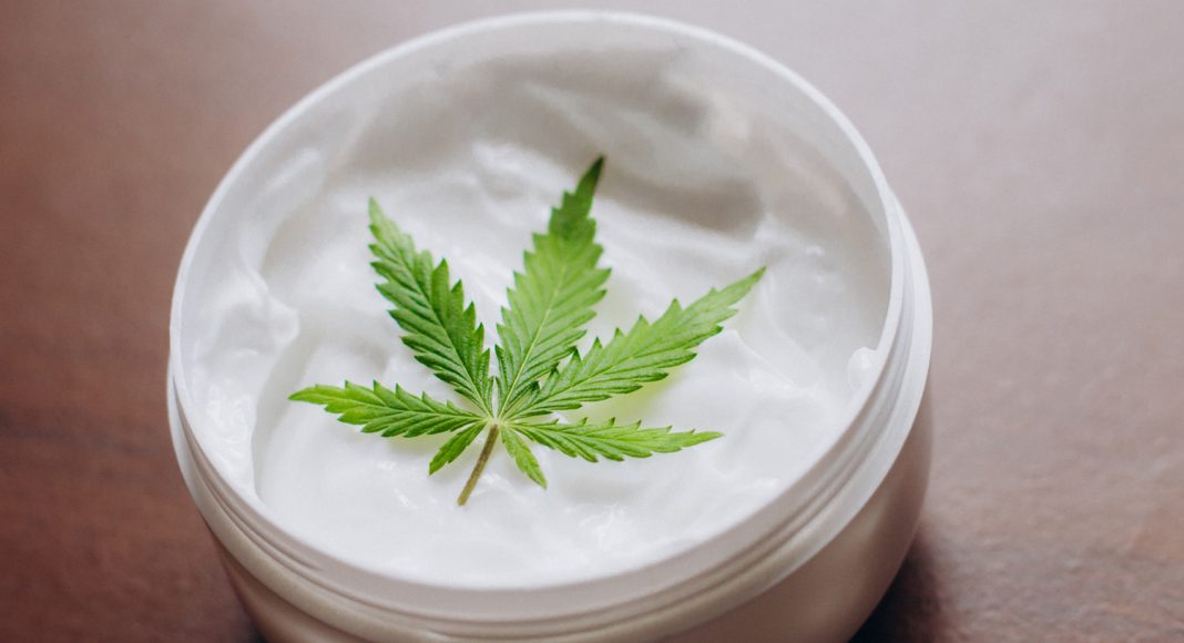 can cbd lotion help hives