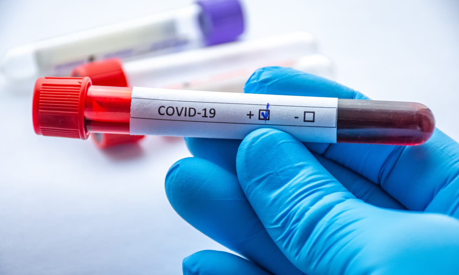 What New Guidelines For Serology Testing Mean For COVID-19