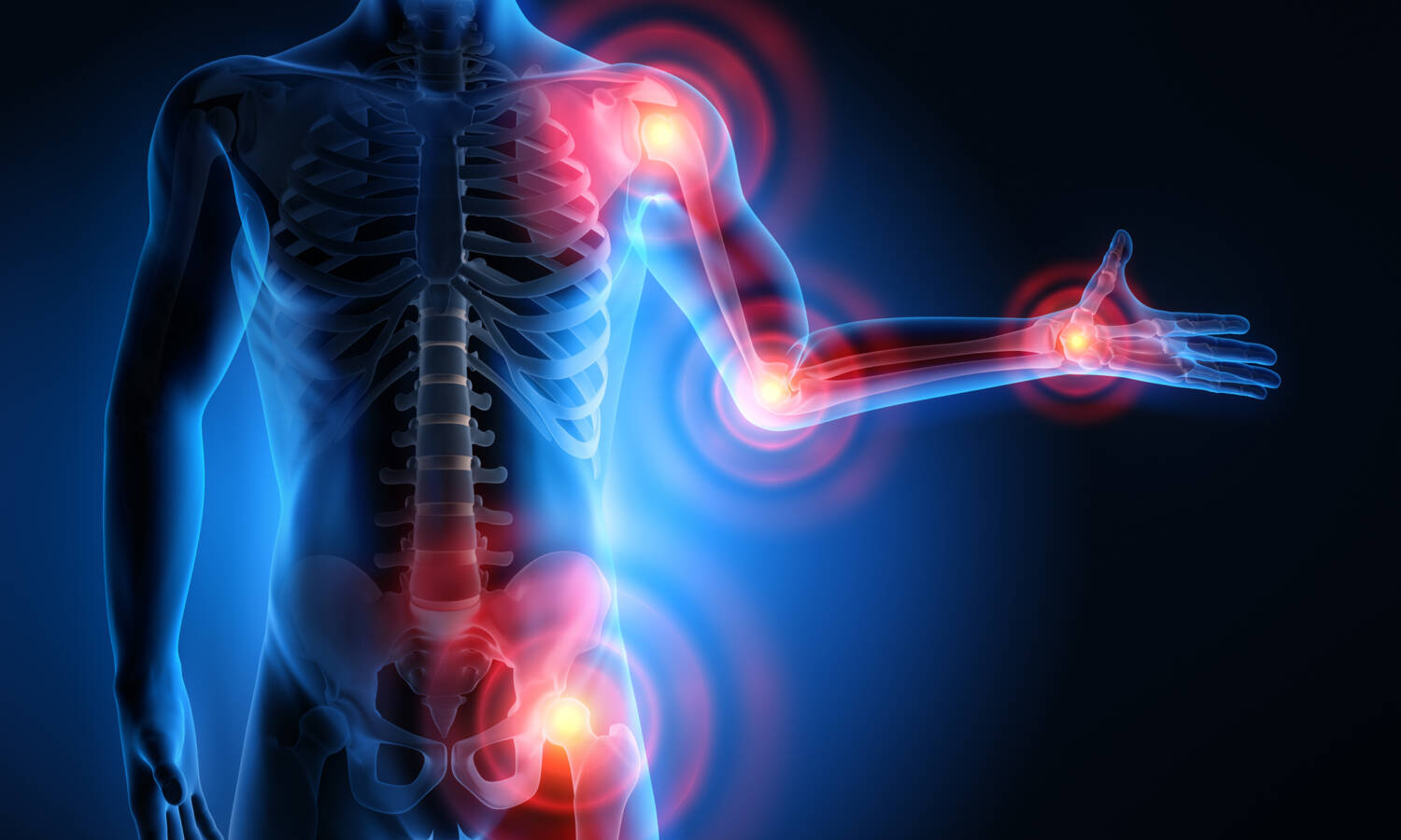 inflammation chronic pain